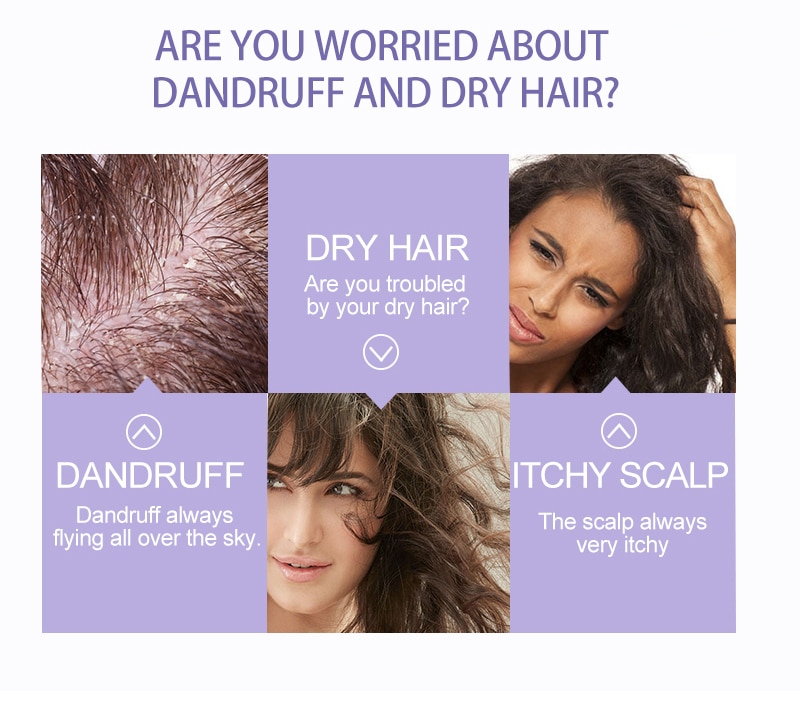 Suitable for dry hair, dandruff and itchy scalp